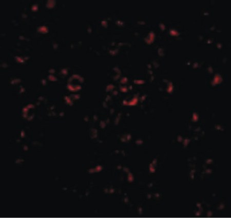 Immunofluorescence of Mcl-1 in Raji cells with Mcl-1 antibody at 20 ug/ml.