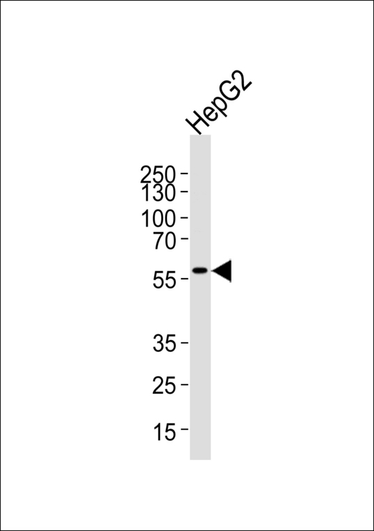 Western blot of lysate from HepG2 cell line, using MLLT3 C-term Antibody. Antibody was diluted at 1:1000 at each lane. A goat anti-rabbit IgG H&L (HRP) at 1:5000 dilution was used as the secondary antibody. Lysate at 35ug per lane.