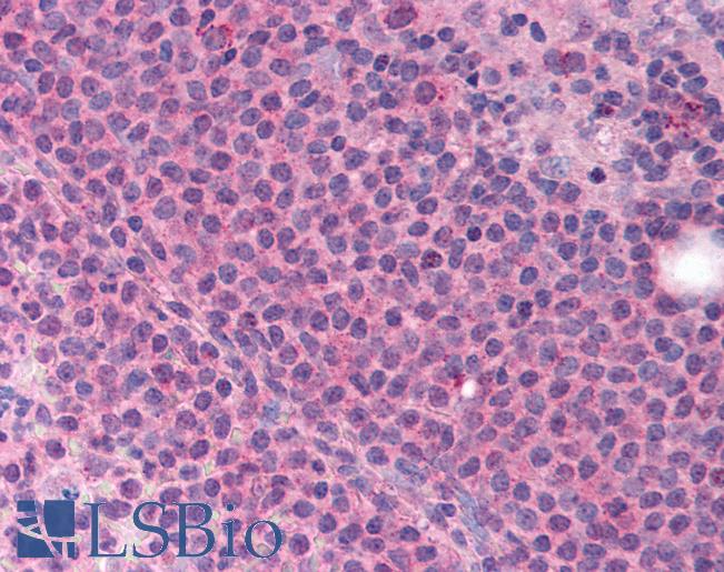 Anti-MLLT4 / Afadin antibody IHC of human spleen. Immunohistochemistry of formalin-fixed, paraffin-embedded tissue after heat-induced antigen retrieval. Antibody LS-B871 concentration 5 ug/ml.