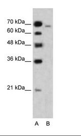 A: Marker, HepG2 Cell Lysate