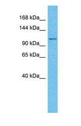 Western blot of AF17 Antibody with human PANC1 Whole Cell lysate.