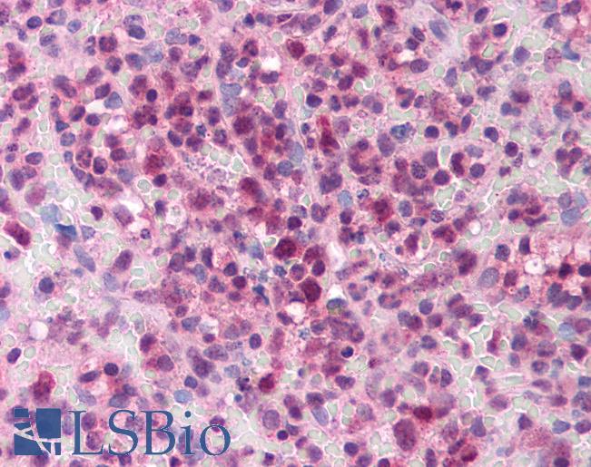 Anti-MLLT6 antibody IHC of human spleen. Immunohistochemistry of formalin-fixed, paraffin-embedded tissue after heat-induced antigen retrieval. Antibody LS-B872 concentration 5 ug/ml.