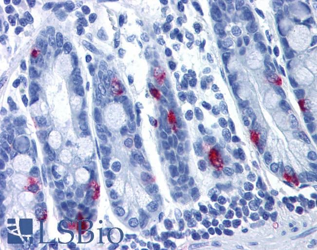 Anti-MLNR antibody LS-A135 IHC of human small intestine. Immunohistochemistry of formalin-fixed, paraffin-embedded tissue after heat-induced antigen retrieval.