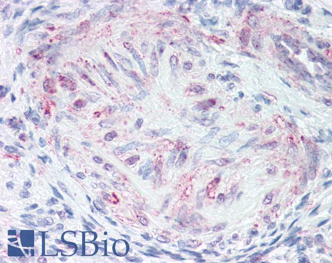 Anti-MLNR antibody LS-A136 IHC of human uterus, vessel. Immunohistochemistry of formalin-fixed, paraffin-embedded tissue after heat-induced antigen retrieval.