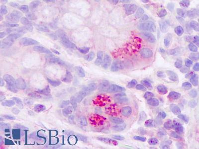 Anti-MLNR / Motilin Receptor antibody IHC of human small intestine, Paneth cells. Immunohistochemistry of formalin-fixed, paraffin-embedded tissue after heat-induced antigen retrieval. Antibody LS-A134 dilution 1 ug/ml.
