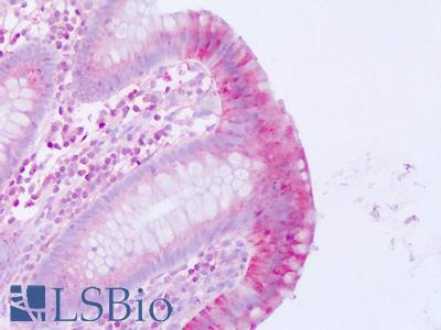 Anti-MLNR / Motilin Receptor antibody IHC of human colon, epithelium. Immunohistochemistry of formalin-fixed, paraffin-embedded tissue after heat-induced antigen retrieval. Antibody LS-A134 dilution 1 ug/ml.