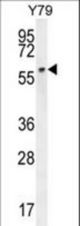LCOR Antibody western blot of Y79 cell line lysates (35 ug/lane). The LCOR antibody detected the LCOR protein (arrow).