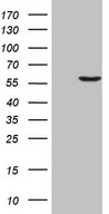 HEK293T cells were transfected with the pCMV6-ENTRY control (Left lane) or pCMV6-ENTRY LCOR (Right lane) cDNA for 48 hrs and lysed. Equivalent amounts of cell lysates (5 ug per lane) were separated by SDS-PAGE and immunoblotted with anti-LCOR (1:2000).