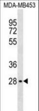 GBL Antibody western blot of MDA-MB453 cell line lysates (35 ug/lane). The GBL antibody detected the GBL protein (arrow).