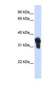 MLX antibody LS-C109790 Western blot of Transfected 293T cell lysate.