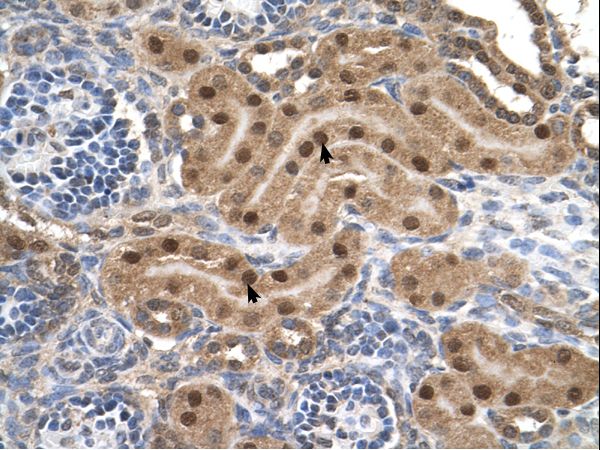 MLX antibody LS-C80294 was used in IHC to stain formalin-fixed, paraffin-embedded human kidney.