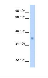 Transfected 293T cell lysate. Antibody concentration: 0.5 ug/ml. Gel concentration: 12%.