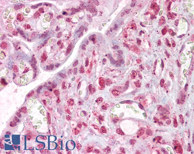 Anti-MLX antibody IHC of human placenta. Immunohistochemistry of formalin-fixed, paraffin-embedded tissue after heat-induced antigen retrieval. Antibody LS-B6494 concentration 2.5 ug/ml.