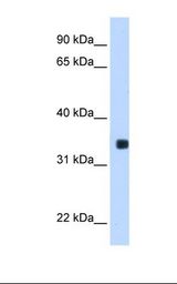 Transfected 293T cell lysate. Antibody concentration: 0.25 ug/ml. Gel concentration: 12%.