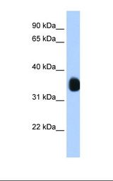 Transfected 293T cell lysate. Antibody concentration: 1.25 ug/ml. Gel concentration: 12%.