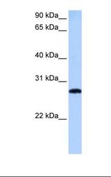 721_B cell lysate. Antibody concentration: 0.5 ug/ml. Gel concentration: 12%.