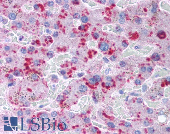 Anti-MLXIPL / CHREBP antibody IHC of human liver. Immunohistochemistry of formalin-fixed, paraffin-embedded tissue after heat-induced antigen retrieval. Antibody LS-B254 concentration 5 ug/ml.