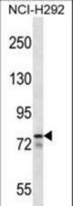MLXIPL Antibody western blot of NCI-H292 cell line lysates (35 ug/lane). The MLXIPL antibody detected the MLXIPL protein (arrow).