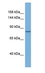 MLXIPL / CHREBP antibody Western Blot of Mouse Thymus. Antibody dilution: 1 ug/ml.