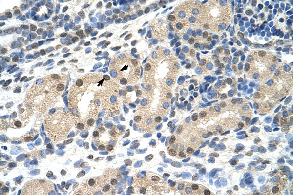 MLXIPL / CHREBP antibody LS-C31701 IHC of formalin-fixed, paraffin-embedded human Kidney. Positive label: Epithelial cells of renal tubule indicated with arrows. Antibody concentration 4-8 ug/ml. Magnification 400X.