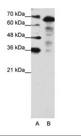 A: Marker, B: Jurkat Cell Lysate