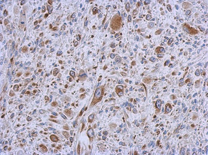 IHC of paraffin-embedded C2C12 xenograft using MMACHC antibody at 1:500 dilution.