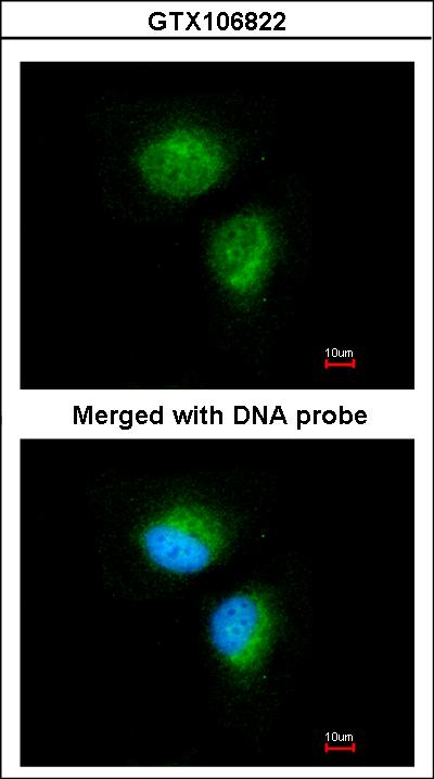 Immunofluorescence of paraformaldehyde-fixed HeLa using MMACHC antibody at 1:100 dilution.