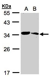 Sample (30 ug whole cell lysate). A:293T, B: Raji . 12% SDS PAGE. MMACHC antibody diluted at 1:1000