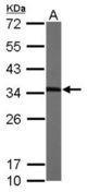 Sample (50 ug of whole cell lysate). A: Mouse brain. 12% SDS PAGE. MMACHC antibody diluted at 1:1000.