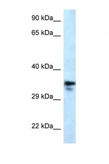 MMACHC antibody LS-C145664 Western blot of U937 Cell lysate. Antibody concentration 1 ug/ml.