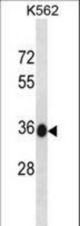 MMACHC Antibody western blot of K562 cell line lysates (35 ug/lane). The MMACHC antibody detected the MMACHC protein (arrow).