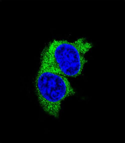 Confocal immunofluorescent of MMP1 Antibody with MDA-MB231 cell followed by Alexa Fluor 488-conjugated goat anti-rabbit lgG (green). DAPI was used to stain the cell nuclear (blue).