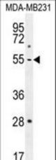 MMP1 Antibody western blot of MDA-MB231 cell line lysates (35 ug/lane). The MMP1 antibody detected the MMP1 protein (arrow).