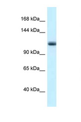 MCM10 antibody LS-C145321 Western blot of Mouse Pancreas lysate. Antibody concentration 1 ug/ml.
