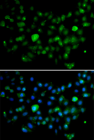 Immunofluorescence blot of A549 cell using MCM10 antibody. Blue: DAPI for nuclear staining.