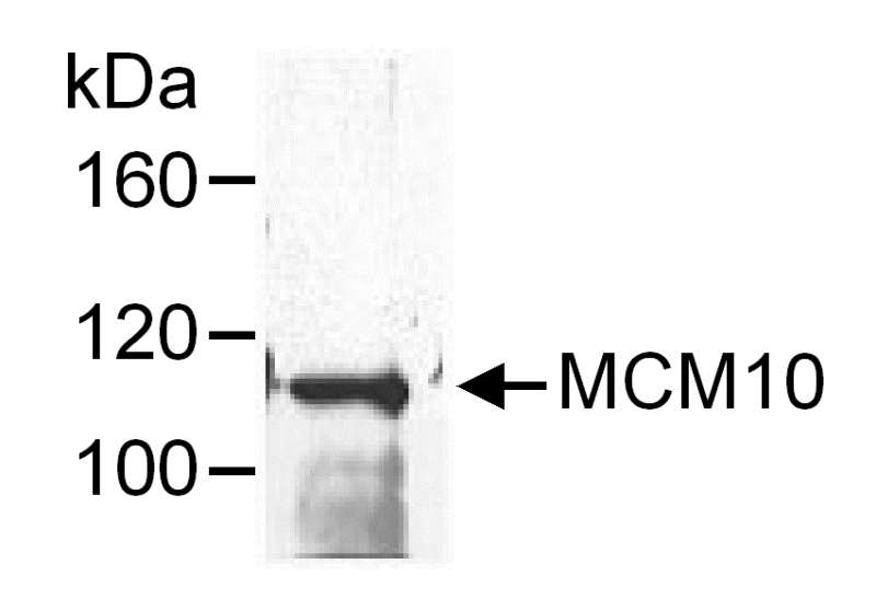 Detection of Human MCM10 by Western Blot following Immunoprecipitation. Sample: HeLa cell lysate (1 mg for IP). Similar results were obtained with HCT116 cells (not shown). Antibody: Affinity purified rabbit anti-MCM10 used at 1 ug/mg lysate for IP and 0.5 ug/ml for WB. Detection: Chemiluminescence.