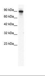 Jurkat Cell Lysate