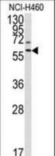Western blot of anti-MMP17 Antibody in NCI-H460 cell line lysates (35 ug/lane). MMP17(arrow) was detected using the purified antibody.