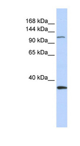 MCM2 antibody LS-C110186 Western blot of Fetal Brain lysate.