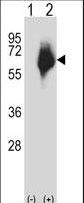 Western blot of MMP2 (arrow) using rabbit polyclonal MMP2 Antibody. 293 cell lysates (2 ug/lane) either nontransfected (Lane 1) or transiently transfected (Lane 2) with the MMP2 gene.