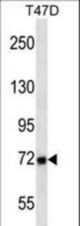 MMP2 Antibody western blot of T47D cell line lysates (35 ug/lane). The MMP2 antibody detected the MMP2 protein (arrow).