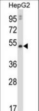 MMP20 Antibody western blot of HepG2 cell line lysates (35 ug/lane). The MMP20 antibody detected the MMP20 protein (arrow).
