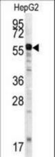 Western blot of anti-MMP20 Antibody in HepG2 cell line lysates (35 ug/lane). MMP20 (arrow) was detected using the purified antibody.