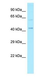 MMP25 / Leukolysin antibody Western Blot of HeLa.