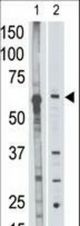 The anti-MMP25 C-term Antibody is used in Western blot to detect MMP25 in mouse liver tissue lysate (lane 1) and HL60 cell lysate (lane 2) lysate.
