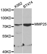 Western blot analysis of extracts of various cell lines, using MMP25 antibody.