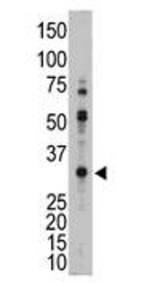 Western analysis of 293T cell lysate