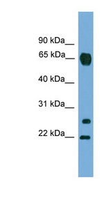 MMP26 antibody LS-C117145 Western blot of A549 cell lysate.