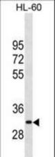 MMP26 Antibody western blot of HL-60 cell line lysates (35 ug/lane). The MMP26 antibody detected the MMP26 protein (arrow).