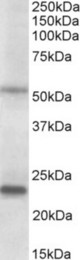 MMP3 antibody (0.2 ug/ml) staining of Prostate lysate (35 ug protein in RIPA buffer). Primary incubation was 1 hour. Detected by chemiluminescence.